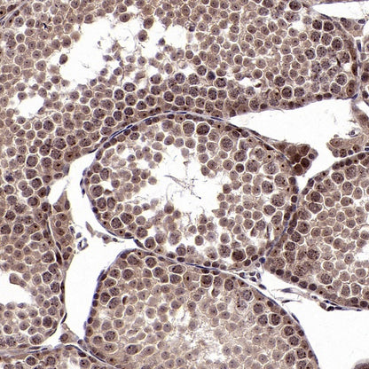 cIAP2 Recombinant Rabbit mAb (S-2483-8)