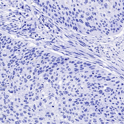 PMEL/Melanoma gp100 Recombinant Rabbit mAb (SDT-3393)