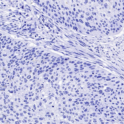 PMEL/Melanoma gp100 Recombinant Rabbit mAb (SDT-3393)