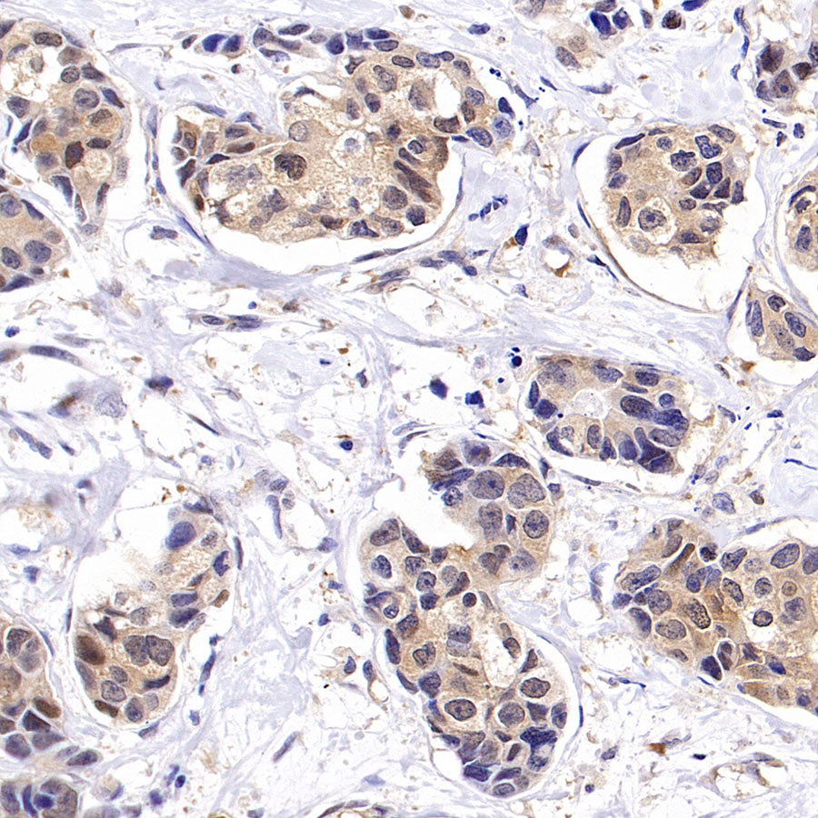 Tug Recombinant Rabbit mAb (S-4377-21)