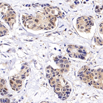 Tug Recombinant Rabbit mAb (S-4377-21)
