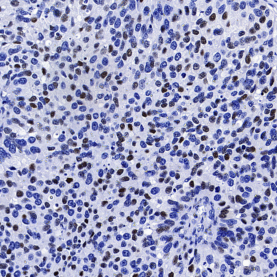 Cyclin E1 Recombinant Rabbit mAb (SDT-4375-44)