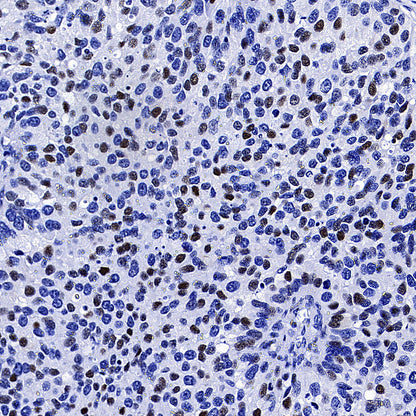 Cyclin E1 Recombinant Rabbit mAb (SDT-4375-44)
