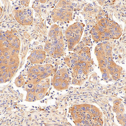 EIF2S2 Rabbit Polyclonal Antibody