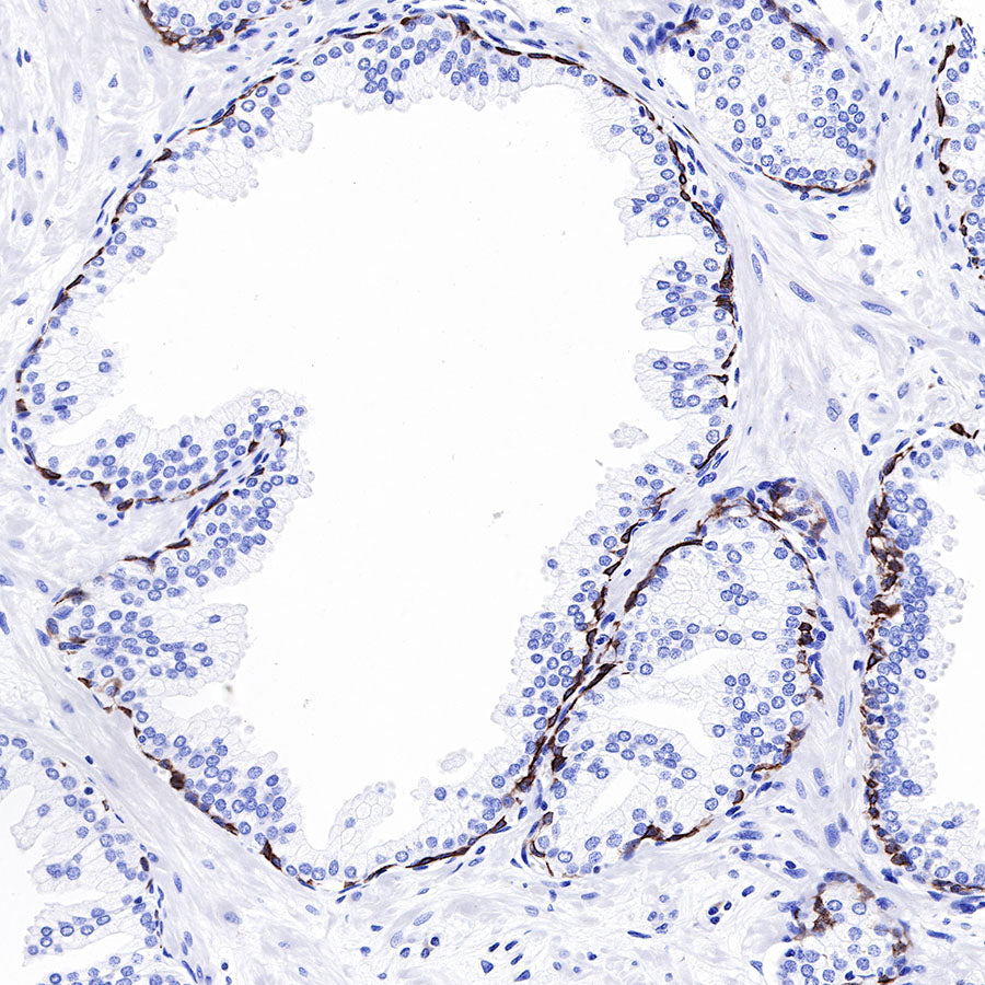 keratin 6 Rabbit mAb (SDT-015-69)