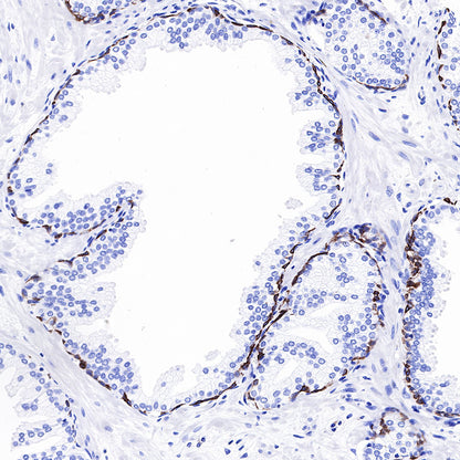 keratin 6 Rabbit mAb (SDT-015-69)