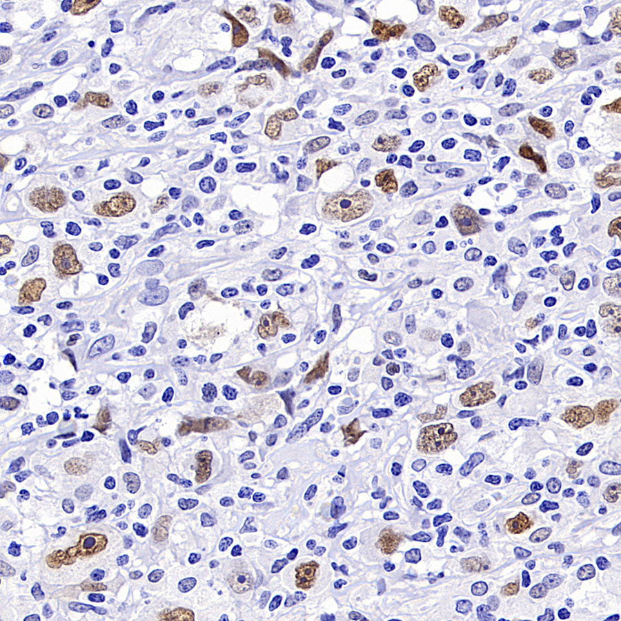 ATF3 Recombinant Rabbit mAb (S-3904)