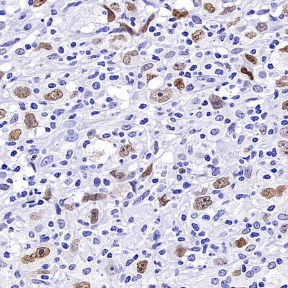 ATF3 Recombinant Rabbit mAb (S-3904)