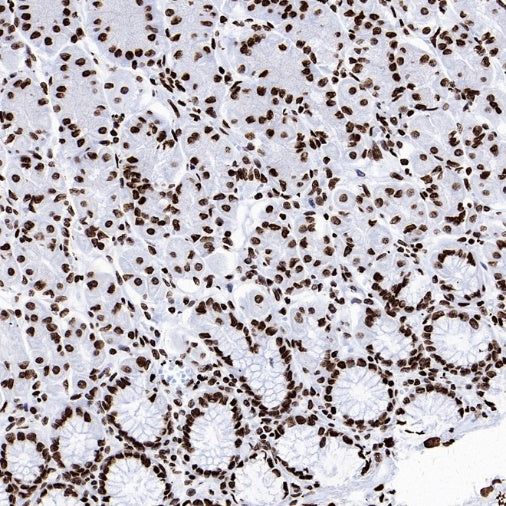 Histone H4 (Lactyl K8) Recombinant Rabbit mAb (S-3243-36)