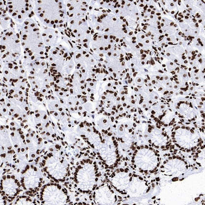 Histone H4 (Lactyl K8) Recombinant Rabbit mAb (S-3243-36)