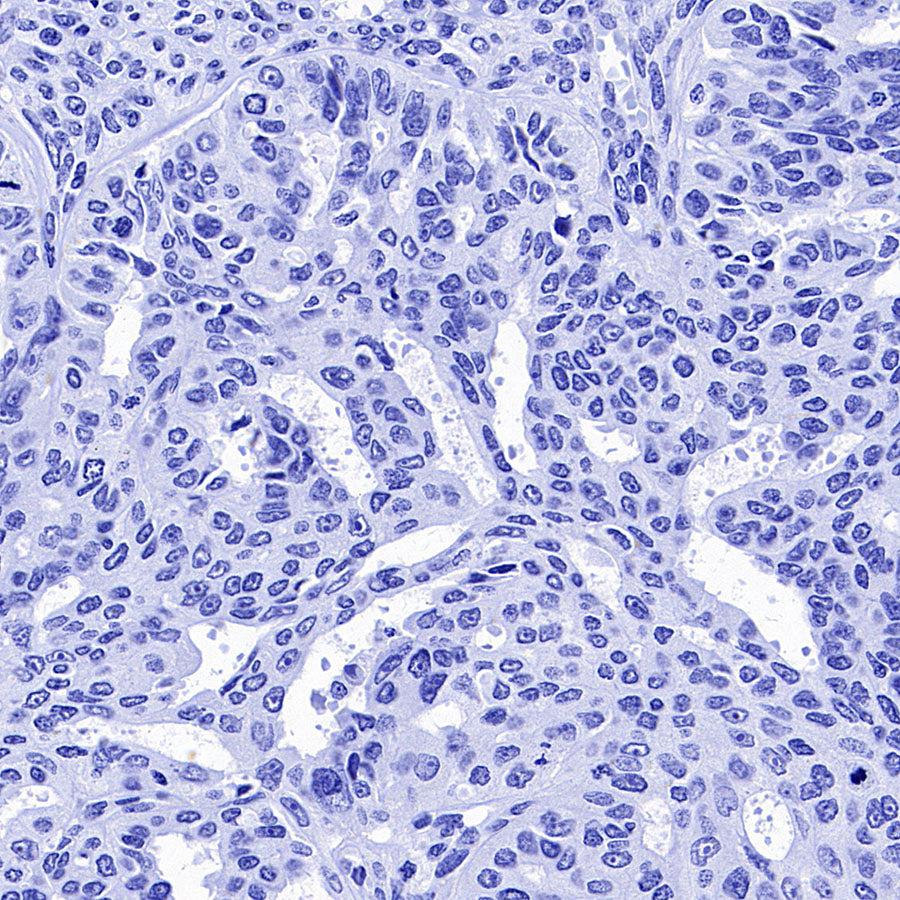 AGXT Recombinant Rabbit mAb (S-3586-30)