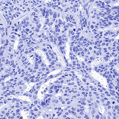 AGXT Recombinant Rabbit mAb (S-3586-30)