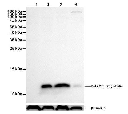 Beta 2 microglobulin Recombinant rabbit mAb (SDT-096-100)