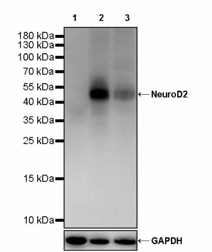 NeuroD2 Recombinant Rabbit mAb (S-3092-64)