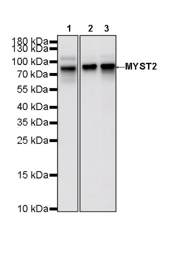 MYST2 Recombinant Rabbit mAb (S-3730-123)