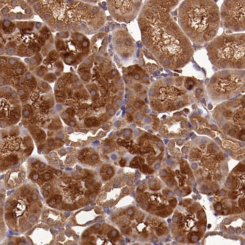 PLCG1 Recombinant Rabbit mAb (S-978-37)