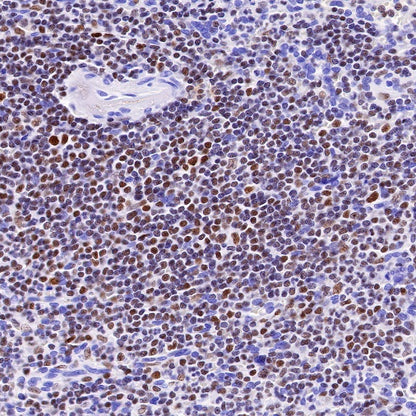 IKAROS Recombinant Rabbit mAb (S-R264)