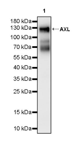 AXL Recombinant Rabbit mAb (S-2199-80)