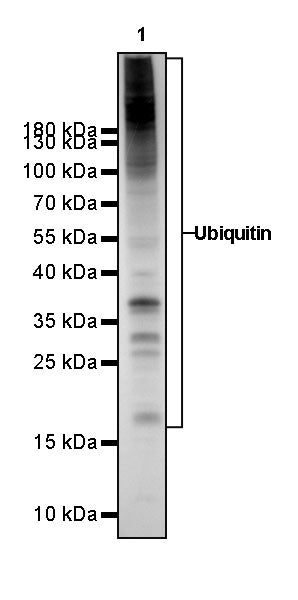 Ubiquitin Rabbit mAb (SDT-R095)