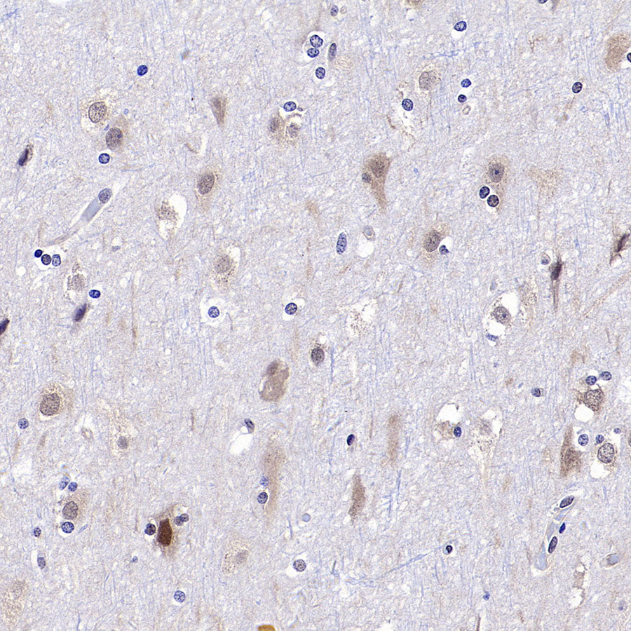 DCAF8 Recombinant Rabbit mAb (S-3483-11)