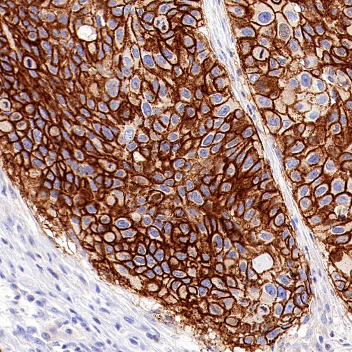 CD44v6 Mouse mAb (S-945-76)