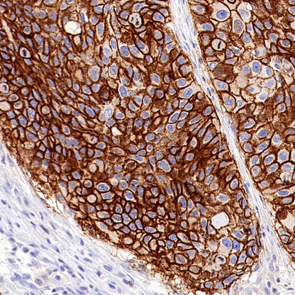 CD44v6 Mouse mAb (S-945-76)