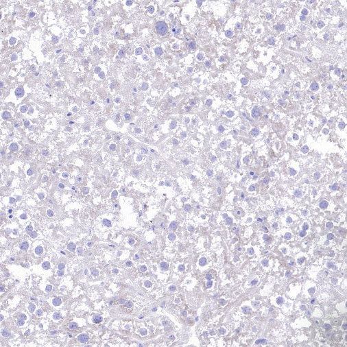 KCND2 Recombinant Rabbit mAb (S-3102-32)