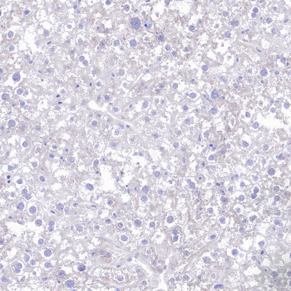 KCND2 Recombinant Rabbit mAb (S-3102-32)