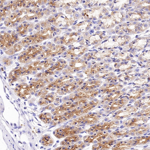VPS26 Rabbit Polyclonal Antibody
