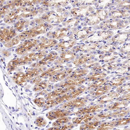 VPS26 Rabbit Polyclonal Antibody