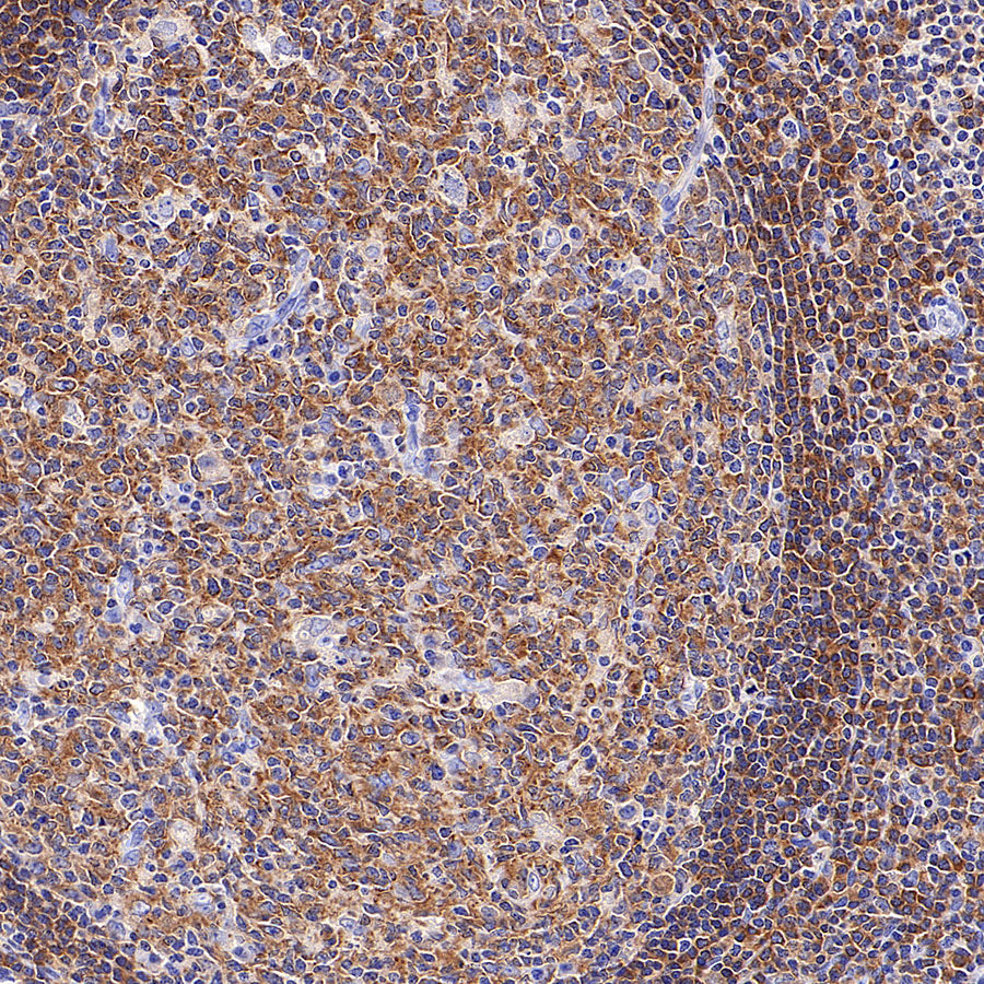 SHIP1 Recombinant Rabbit mAb (S-4235-32)