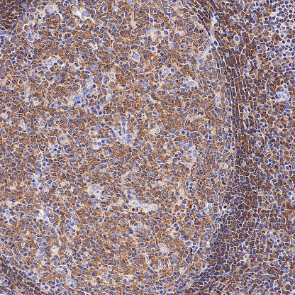 SHIP1 Recombinant Rabbit mAb (S-4235-32)