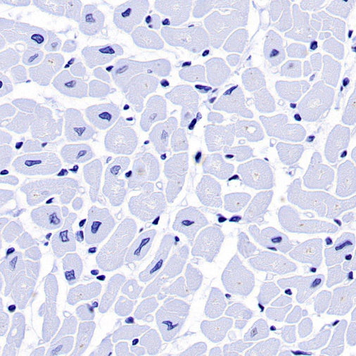 FSHB Recombinant Rabbit mAb (SDT-R287)