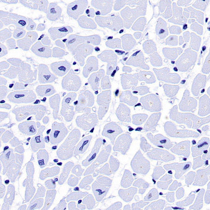 FSHB Recombinant Rabbit mAb (SDT-R287)