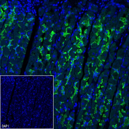 MYO7A Recombinant Rabbit mAb (S-2284-21)
