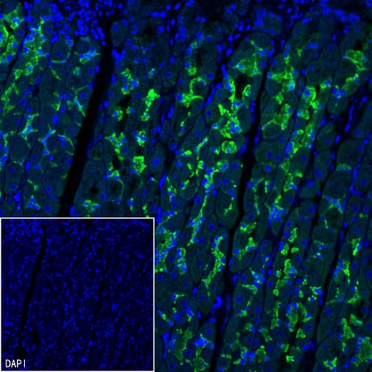 MYO7A Recombinant Rabbit mAb (S-2284-21)