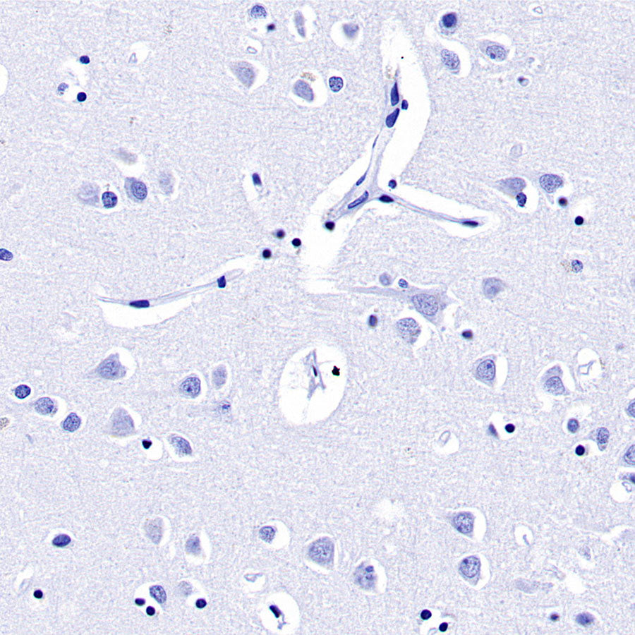 Prolactin/PRL Recombinant Rabbit mAb (SDT-235-13)