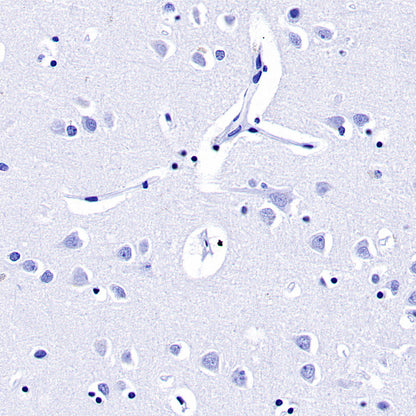 Prolactin/PRL Recombinant Rabbit mAb (SDT-235-13)