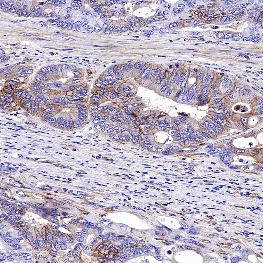 PTK7 Recombinant Rabbit mAb (SDT-2432-136)