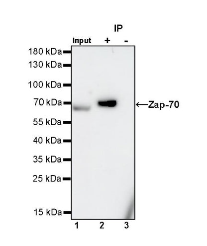 Zap-70 Recombinant Rabbit mAb (S-1249-32)