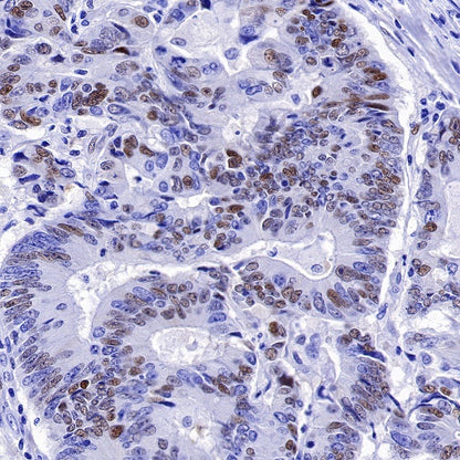 Cyclin D1 Recombinant Rabbit mAb (SDT-R423)