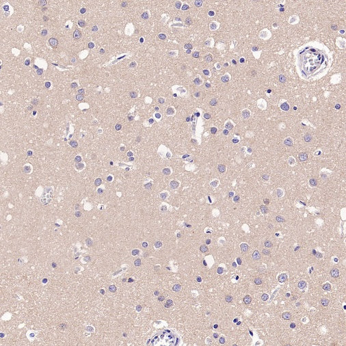 UBE2F Recombinant Rabbit mAb (S-2672-26)