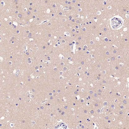 UBE2F Recombinant Rabbit mAb (S-2672-26)
