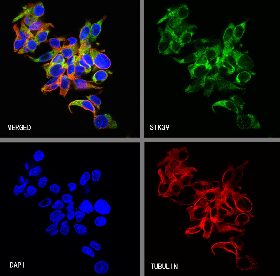 STK39 Recombinant Rabbit mAb (S-3630-15)