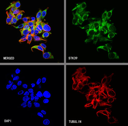 STK39 Recombinant Rabbit mAb (S-3630-15)
