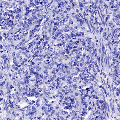 S-RMab® FGFR2b Recombinant Rabbit mAb (SDT-423-33)