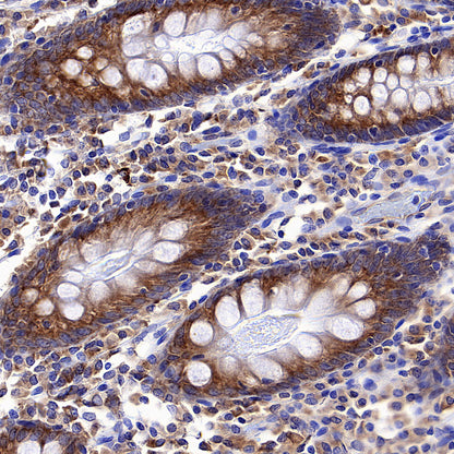 CCDC47 Recombinant Rabbit mAb (S-4158-17)