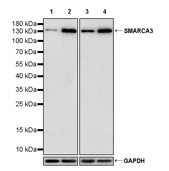 SMARCA3 Recombinant Rabbit mAb (S-3575-154)