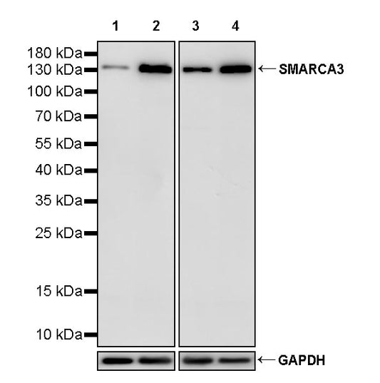 SMARCA3 Recombinant Rabbit mAb (S-3575-154)