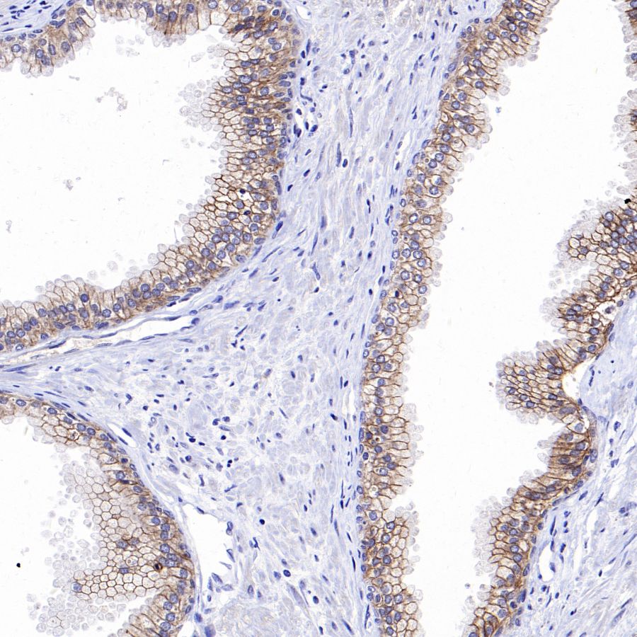 Desmocollin-2/3(DSC2/3) Recombinant Rabbit mAb (SDT-2102-59)